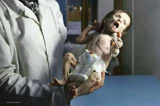 سوريا : صور صادمة لرضيعة سورية تجتاج مواقع التواصل (شاهد)