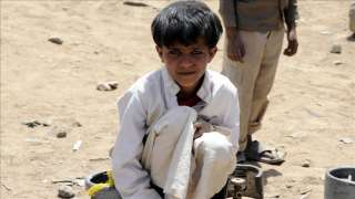 ”يونيسف”: 400 ألف طفل يمني معرضون للموت جراء سوء التغذية الحاد