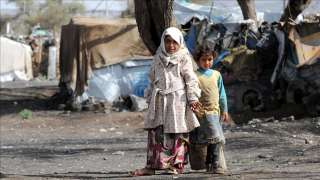 اليمن | منظمة بريطانية تقدر وفاة 85 ألف طفل يمني بسبب سوء التغذية