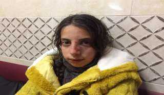 إصابة طفلة فلسطينية في وجهها إثر محاولة مستوطنين اختطافها جنوبي نابلس